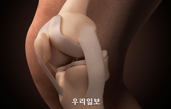 관절염 증상 ⓒ 연세건우병원 제공